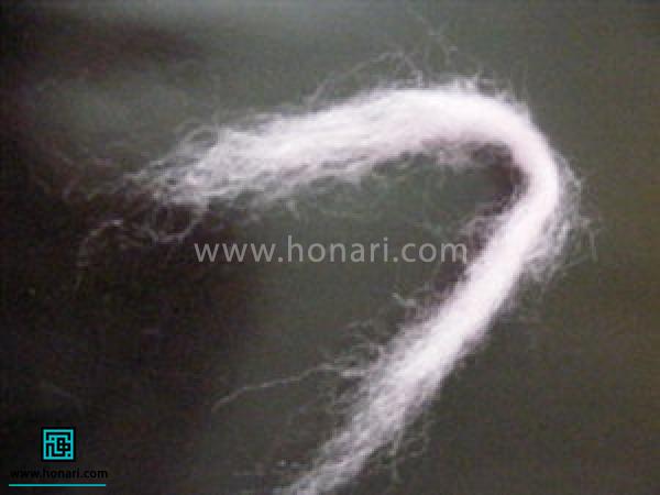 Ø¨Ø±Ø§Û Ø¨ÛÙÛ Ø®Ø±Ú¯ÙØ´ØØ¨Ù Ø§ÙØ¯Ø§Ø²Ù Ø·Ù٠ک٠دست Ù Ù¾ÙÙØ§Û ÛÚ© Ù
داد اÙÛØ§Ù ØµÙØ±ØªÛ برداشتÙ