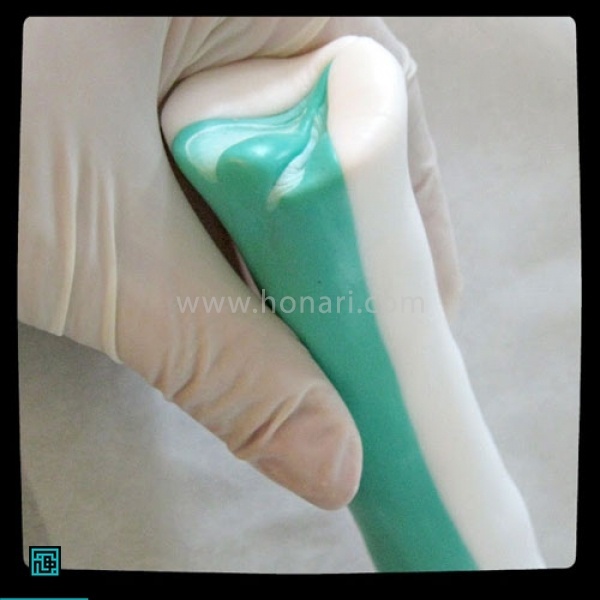 Ø§ÛÙÚ©Ø§Ø± Ø±Ø§ ÙØ¬Ø¯Ø¯Ø§ ØªÚ©Ø±Ø§Ø± ÙÛÚ©ÙÛÙ ØªØ§ ÙØ·Ø± Ø§Ø³ØªÙØ§ÙÙ Ø­Ø¯ÙØ¯ ÛÚ© Ø³Ø§ÙØªÛ ÙØªØ± Ø´ÙØ¯ . Ø§ÙØ¨ØªÙ ØªÙØ¬Ù Ø¯Ø§Ø´ØªÙ Ø¨Ø§Ø´ÛØ¯ Ú©Ù Ø´Ú©Ù Ú©ÙÛ Ø§Ø² Ø¨ÛÙ ÙØ±ÙØ¯