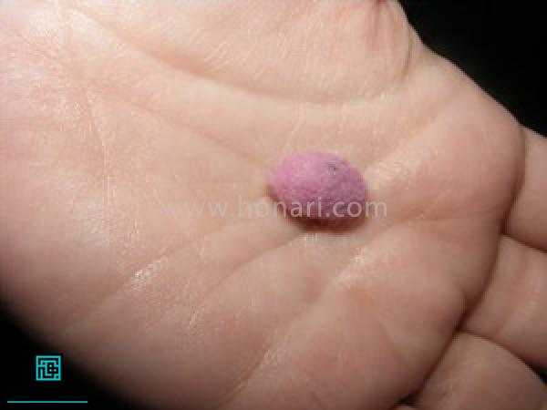 Ø§ÙÛØ§Ù Ø±Ø§ Ø±ÙÙ Ú©Ø±Ø¯Ù Ù Ø¨ØµÙØ±Øª ØªÙÙ¾Ú© Ø¯Ø± Ø¨ÛØ§ÙØ±ÛØ¯ ( Ø§ÛÙ Ú©Ø§Ø± Ø±Ø§ Ø¨Ø§ Ø§ÙÛØ§Ù ÙØ´Ú©Û ÙØ¨Ø±Ø§Û ÚØ´Ù ÙØ§ ÙÛØ² Ø§ÙØ¬Ø§Ù Ø¯ÙÛØ¯)